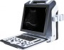 Portabler Farbdoppler mit Technologie von High-End-Geräten